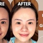 5 Pemutih Wajah Ampuh Atasi Jerawat: Kulit Glowing Bebas Kilap!