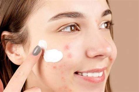 5 Pemutih Wajah Ampuh Atasi Jerawat: Kulit Glowing Bebas Kilap! 5 Pemutih Wajah Ampuh Atasi Jerawat: Kulit Glowing Bebas Kilap!
