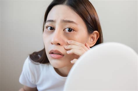 5 Perawatan Wajah Sederhana Untuk Kantung Mata Pria Hilang Total 5 Perawatan Wajah Sederhana Untuk Kantung Mata Pria Hilang Total