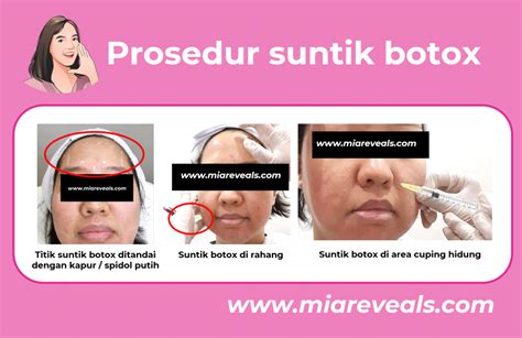 5+ Perawatan Wajib di Alzena: Harga Mulai Rp99 Ribu? 5+ Perawatan Wajib di Alzena: Harga Mulai Rp99 Ribu?