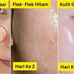 5 Rahasia Sederhana Bikin Pori-Pori Wajah Kedot Klc
