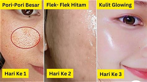 5 Rahasia Sederhana Bikin Pori-Pori Wajah Kedot Klc 5 Rahasia Sederhana Bikin Pori-Pori Wajah Kedot Klc