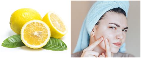 5 Treatment Kulit Ajaib yang Bikin Glowing dalam 7 Hari! 5 Treatment Kulit Ajaib yang Bikin Glowing dalam 7 Hari!
