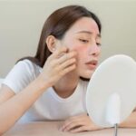 7 Cara Ampuh Atasi Perawatan Wajah Breakout yang Wajib Kamu Coba Sekarang Juga!