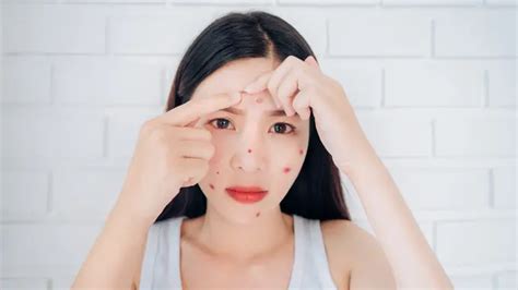 7 Cara Ampuh Atasi Perawatan Wajah Breakout yang Wajib Kamu Coba Sekarang Juga! 7 Cara Ampuh Atasi Perawatan Wajah Breakout yang Wajib Kamu Coba Sekarang Juga!