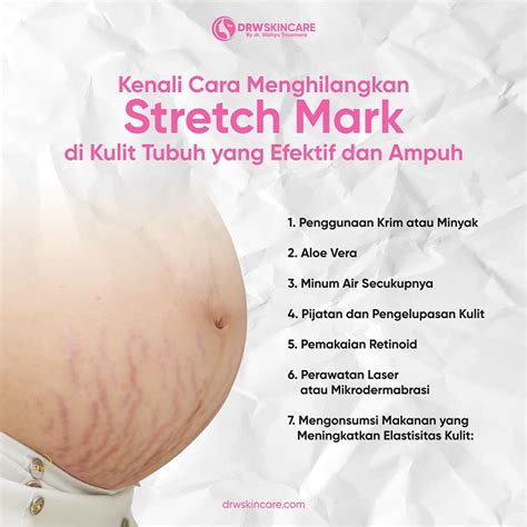 7 Cara Ampuh Menyamarkan Stretch Mark Membandel! 7 Cara Ampuh Menyamarkan Stretch Mark Membandel!