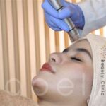 7 Fakta Mengejutkan Biaya Laser Wajah di Solo: Nomor 5 Bikin Dompet Nangis!