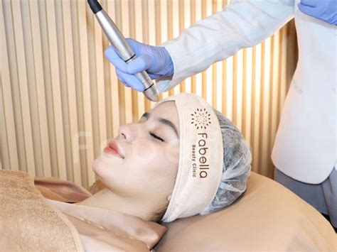 7 Fakta Mengejutkan Biaya Laser Wajah di Solo: Nomor 5 Bikin Dompet Nangis! 7 Fakta Mengejutkan Biaya Laser Wajah di Solo: Nomor 5 Bikin Dompet Nangis!