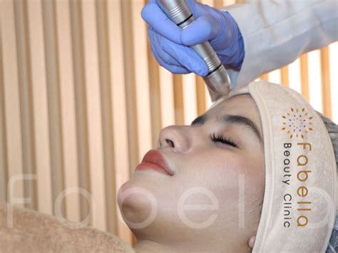 7 Fakta Mengejutkan Biaya Laser Wajah di Solo: Nomor 5 Bikin Dompet Nangis! 7 Fakta Mengejutkan Biaya Laser Wajah di Solo: Nomor 5 Bikin Dompet Nangis!