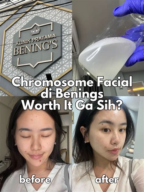 7 Harga Facial di Bening's Clinic, Mulai 90 Ribuan! Rahasia Glowing Tanpa Bikin Kantong Bolong? 7 Harga Facial di Bening's Clinic, Mulai 90 Ribuan! Rahasia Glowing Tanpa Bikin Kantong Bolong?