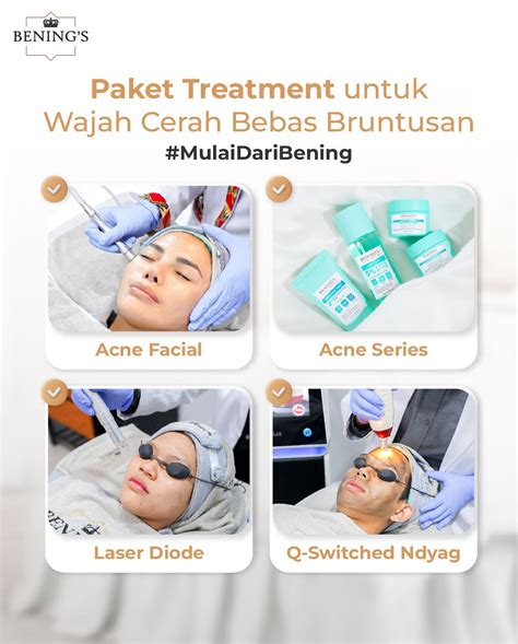 7 Harga Facial di Bening's Clinic, Mulai 90 Ribuan! Rahasia Glowing Tanpa Bikin Kantong Bolong? 7 Harga Facial di Bening's Clinic, Mulai 90 Ribuan! Rahasia Glowing Tanpa Bikin Kantong Bolong?