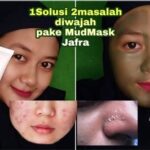 7 Langkah Jitu: Bye-Bye Komedo Bandel!