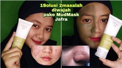 7 Langkah Jitu: Bye-Bye Komedo Bandel! 7 Langkah Jitu: Bye-Bye Komedo Bandel!