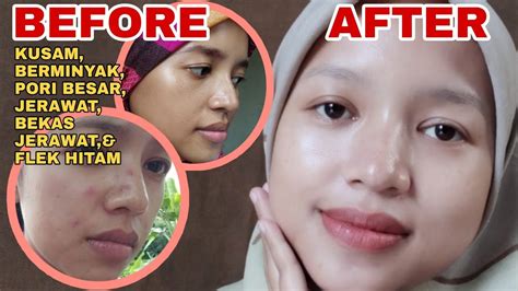 7 Perawatan Larissa di Bawah 50 Ribu! Rahasia Glowing Tanpa Bokek? 7 Perawatan Larissa di Bawah 50 Ribu! Rahasia Glowing Tanpa Bokek?