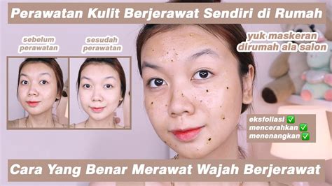 7 Rahasia Kulit Bebas Jerawat: Bye-bye Masalah Wajah! 7 Rahasia Kulit Bebas Jerawat: Bye-bye Masalah Wajah!