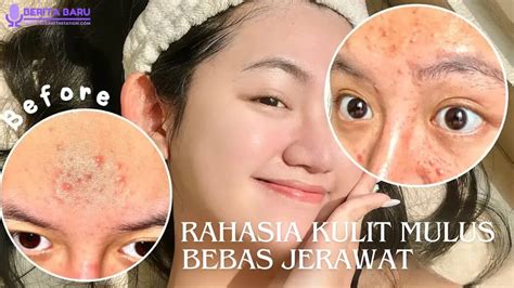 7 Rahasia Kulit Bebas Jerawat: Bye-bye Masalah Wajah!