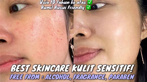 7 Rahasia Kulit Sensitif Bebas Iritasi: Cuma Butuh 5 Menit! 7 Rahasia Kulit Sensitif Bebas Iritasi: Cuma Butuh 5 Menit!