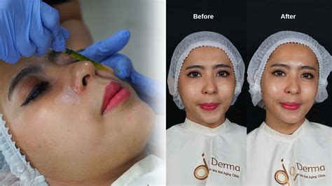 7 Rahasia Perawatan Derma ala Artis Korea untuk Kulit Glowing 7 Rahasia Perawatan Derma ala Artis Korea untuk Kulit Glowing