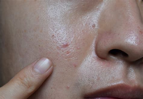 7 Rahasia Perawatan Wajah Glowing Bebas Kusam! 7 Rahasia Perawatan Wajah Glowing Bebas Kusam!