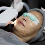 7 Rekomendasi Laser Wajah dengan Harga di Bawah 5 Juta untuk Mendapatkan Kulit Mulus!