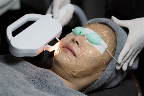 7 Rekomendasi Laser Wajah dengan Harga di Bawah 5 Juta untuk Mendapatkan Kulit Mulus!