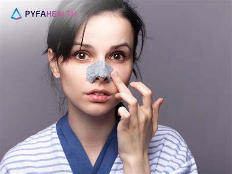7 Treatment Ampuh Basmi Komedo Membandel, Nomor 5 Bikin Kaget! 7 Treatment Ampuh Basmi Komedo Membandel, Nomor 5 Bikin Kaget!