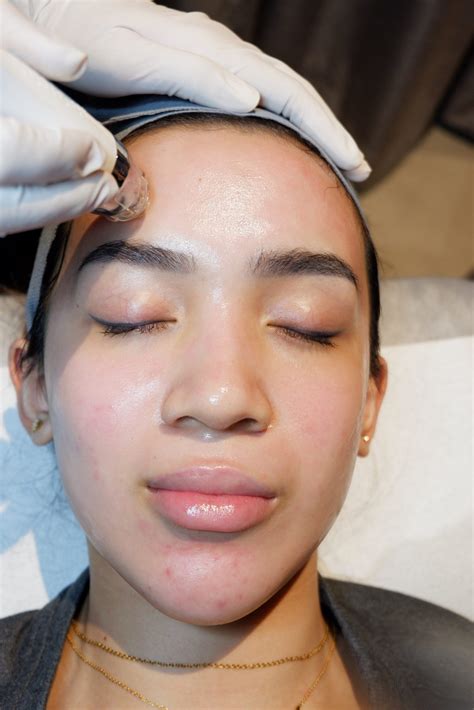 7 Treatment Dermies di Bawah 500 Ribu: Kulit Glowing Gak Harus Mahal! 7 Treatment Dermies di Bawah 500 Ribu: Kulit Glowing Gak Harus Mahal!