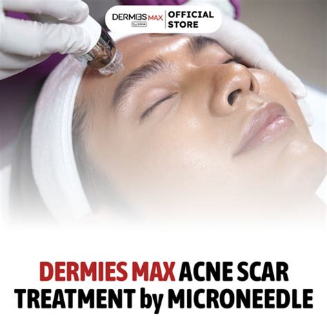 7 Treatment Dermies di Bawah 500 Ribu: Kulit Glowing Gak Harus Mahal! 7 Treatment Dermies di Bawah 500 Ribu: Kulit Glowing Gak Harus Mahal!