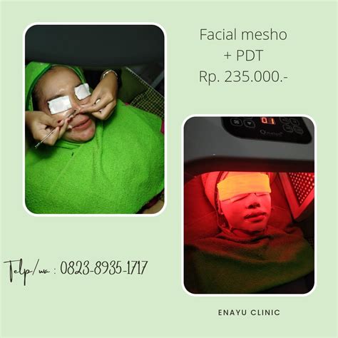 7 Treatment Jerawat Membandel di Bawah 500 Ribu, Bye Wajah Breakout!