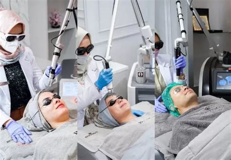 7 Treatment Larissa dengan Harga Mulai Rp 500 Ribu, Cek Daftar Harganya! 7 Treatment Larissa dengan Harga Mulai Rp 500 Ribu, Cek Daftar Harganya!