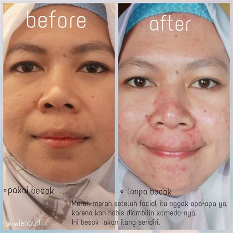 Berapa Biaya Facial di Erha? Siapkan Budget Segini! (Update 2024) Berapa Biaya Facial di Erha? Siapkan Budget Segini! (Update 2024)