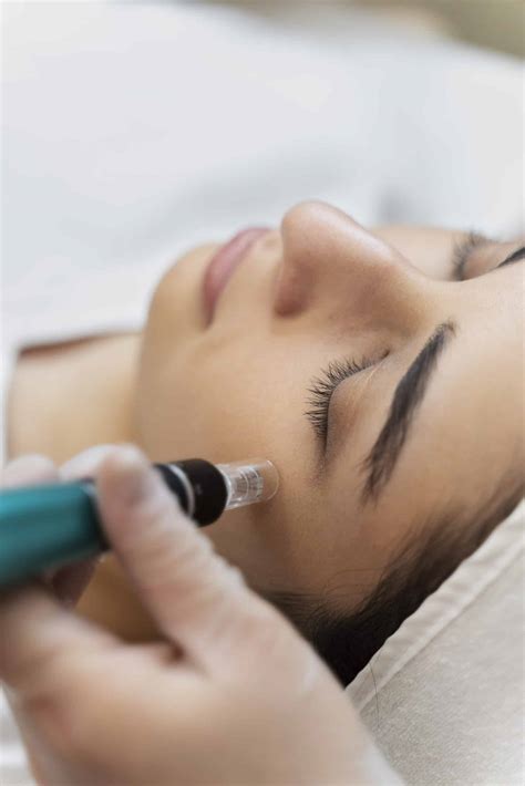 5 Cara Menggunakan Dermapen untuk Perawatan Wajah yang Efektif dalam 7 Hari! 5 Cara Menggunakan Dermapen untuk Perawatan Wajah yang Efektif dalam 7 Hari!