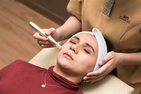 5 Cara Menggunakan Dermapen untuk Perawatan Wajah yang Efektif dalam 7 Hari! 5 Cara Menggunakan Dermapen untuk Perawatan Wajah yang Efektif dalam 7 Hari!