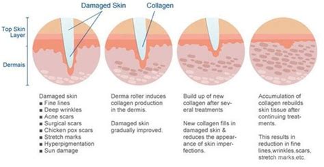 5 Skincare Goals TerwujudSetelah Dermaroller: Wajah Keren and Radiance level 💫