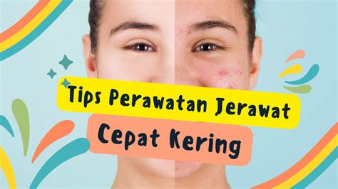 7 Rahasia Ampuh Basmi Wajah Berminyak and Jerawat Membandel! 7 Rahasia Ampuh Basmi Wajah Berminyak and Jerawat Membandel!