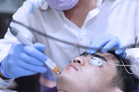 7 Tarif Laser Wajah di Klinik Ternama: Bye Bye Masalah Kulit! 7 Tarif Laser Wajah di Klinik Ternama: Bye Bye Masalah Kulit!